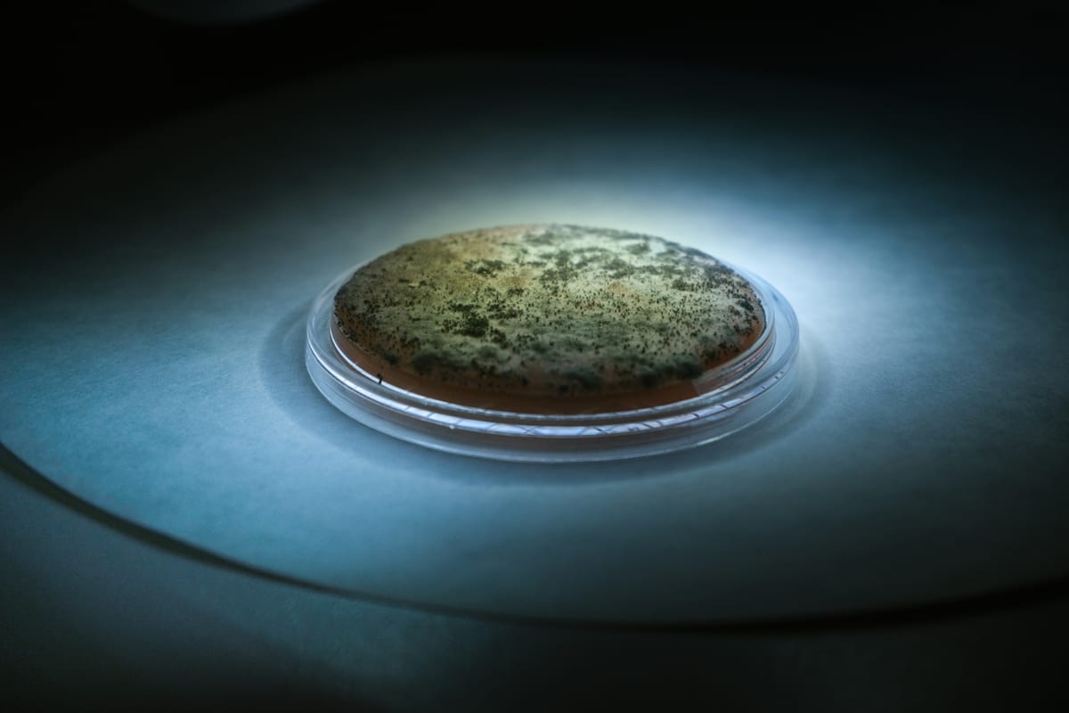 WHO's Antifungal Wake-Up Call Finds India Both Exposed and Positioned